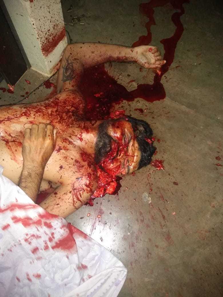 There were more than 30 shots and the last one was 12 in the head, inv