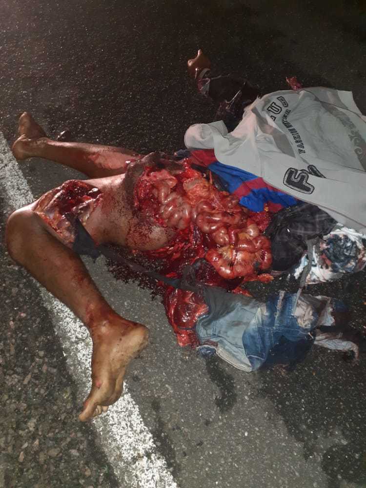Brutal accident man totally shattered (photos)