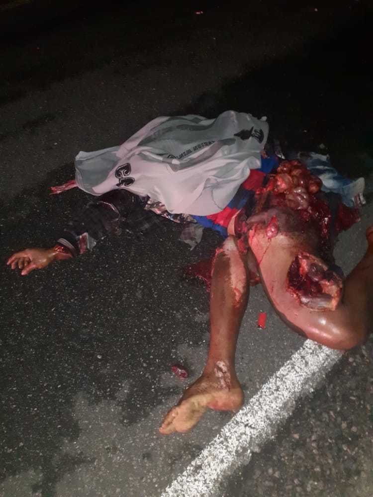 Brutal accident man totally shattered (photos)