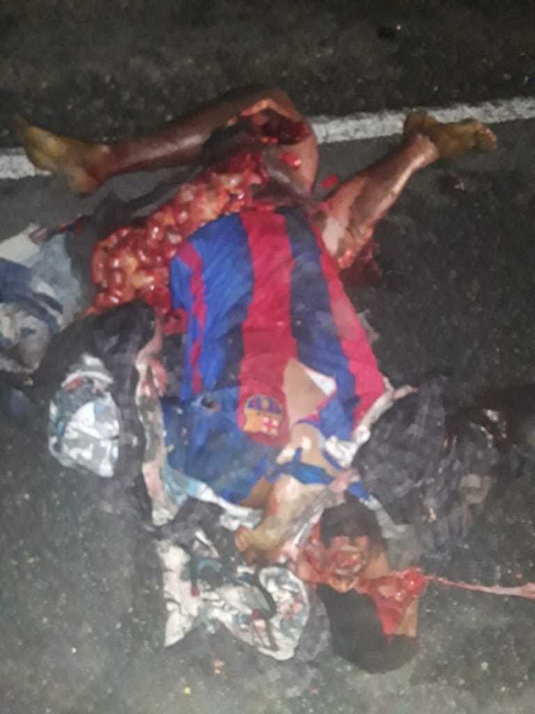 Brutal accident man totally shattered (photos)