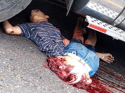 Poor Dude Torn In Half By Truck.