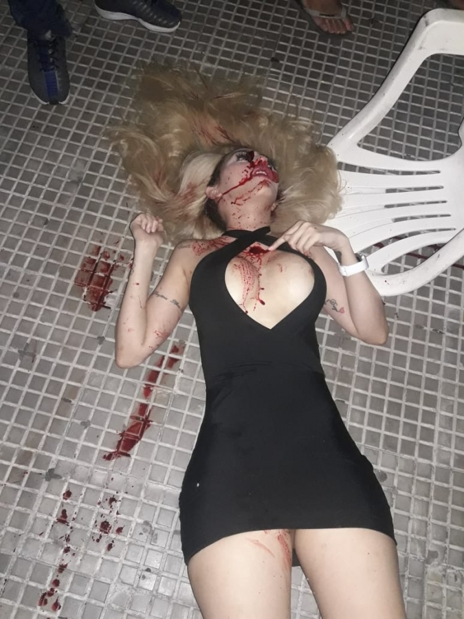 Pretty Call Girl Shot 4 Times