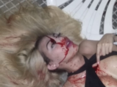 Pretty Call Girl Shot 4 Times