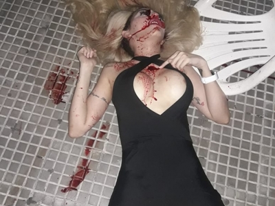 Pretty Call Girl Shot 4 Times