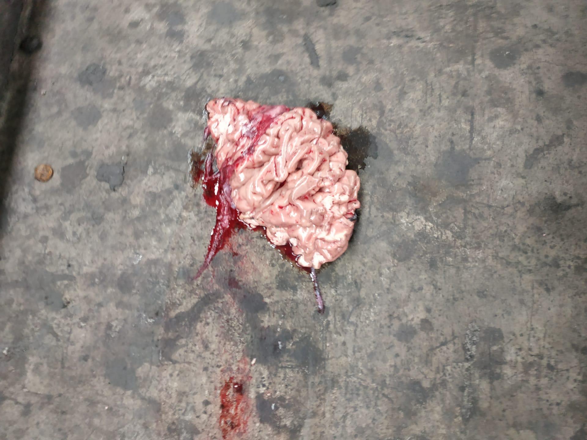 suicide of the metro line