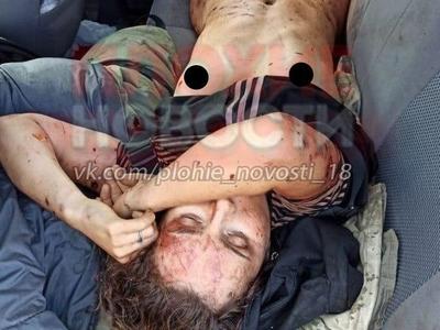 Terrible: the effects of a bear attack