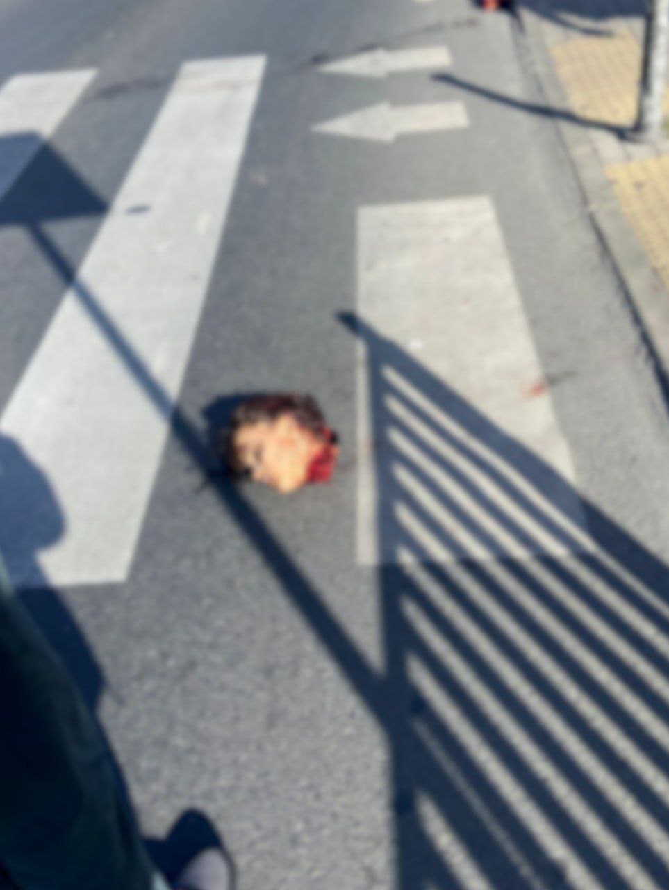 Man Dismembers Ex-Girlfriend's Body and Throws Her Head in Turkiye