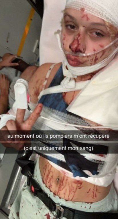 French Teen Is Brutally Assaulted, Slashed by Migrants for Clothing