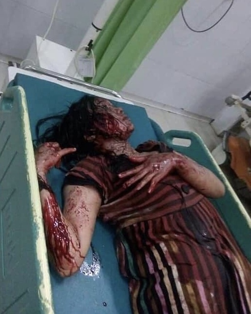 Bloody Violent Theft