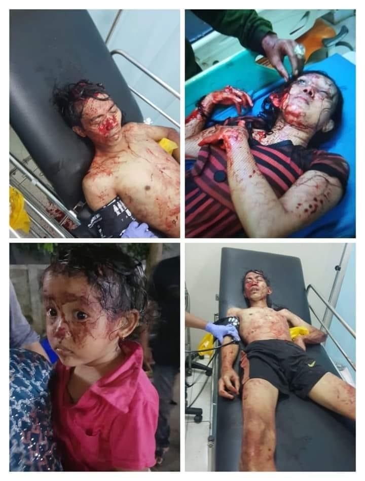 Bloody Violent Theft