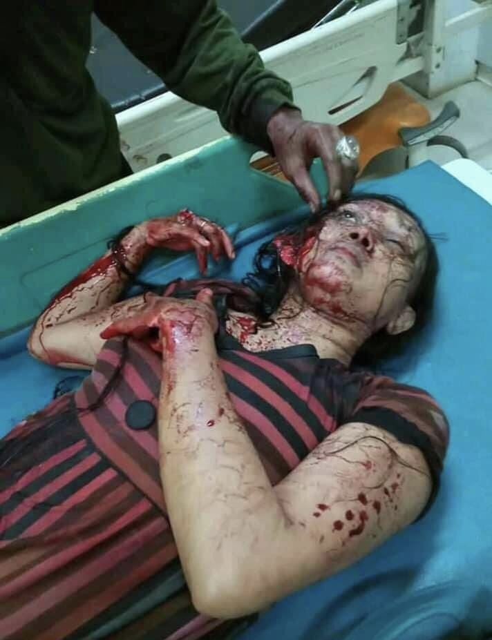 Bloody Violent Theft