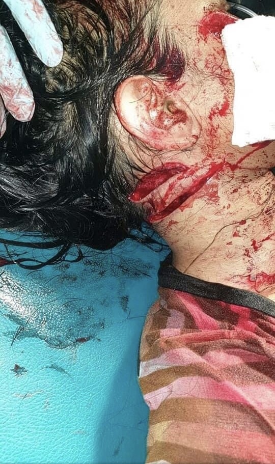 Bloody Violent Theft