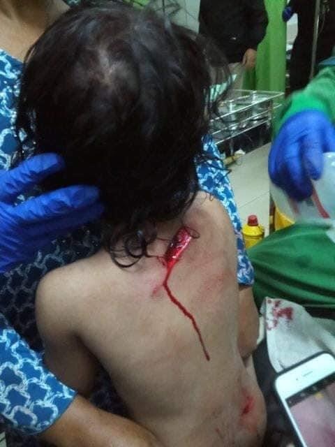 Bloody Violent Theft