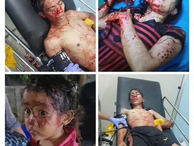 Bloody Violent Theft 