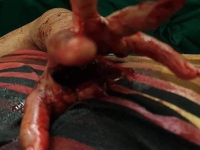 Bloody Violent Theft 