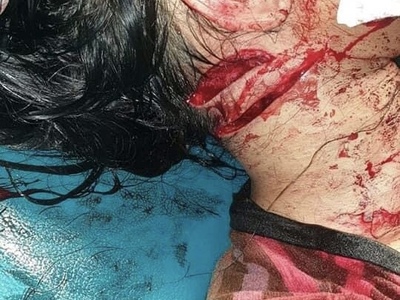 Bloody Violent Theft 