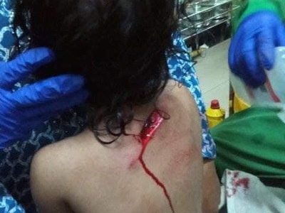 Bloody Violent Theft 