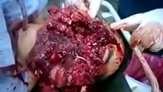 SHOCK Video shows Man Attempted Suicide by Shotgun Fail..He's Still Alive 