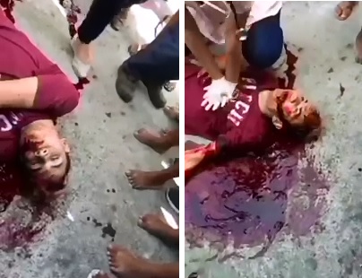 Justin Bieber Look-A-Like wanted to be a Bad Criminal..Shot in the Face and Dying Now..