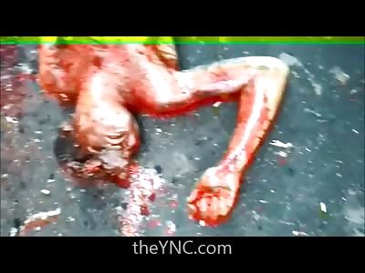 Disgusting Aftermath of man that was Stoned and head Caved In 