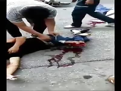 victim of terrible accident 