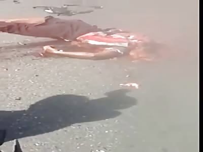 Victim of terrible accident 