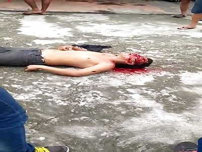 man victim of shots in street 