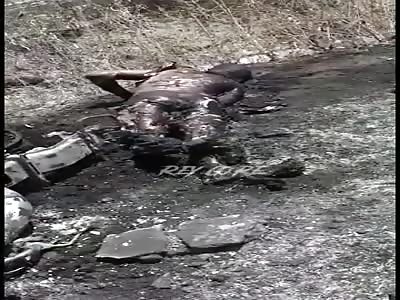 Man burned in terrible accident 