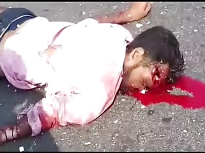 Victim of terrible accident 