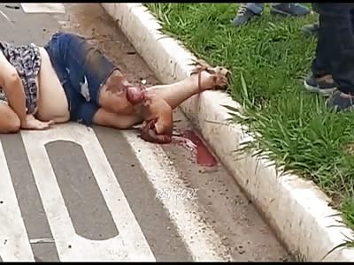 woman victim of terrible accident