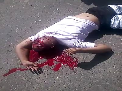 SHOCKING, man  in agony after accident 