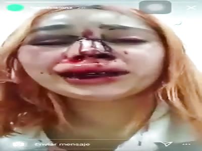 Womam brutally beaten by ColÃ´mbia Police 