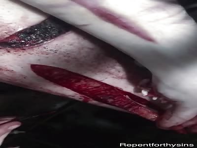 Cutting out another chunk of my leg