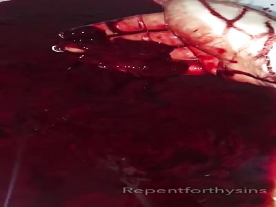 The blood bath