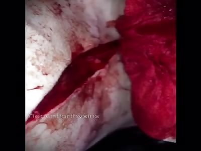 Blood bottle, the chest cut, and scars