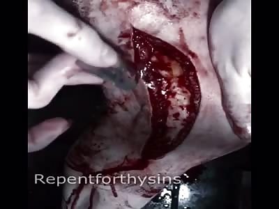 Cutting my leg again