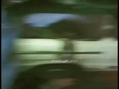 victim of attack bomb burned