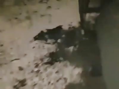 victim of attack bomb burned