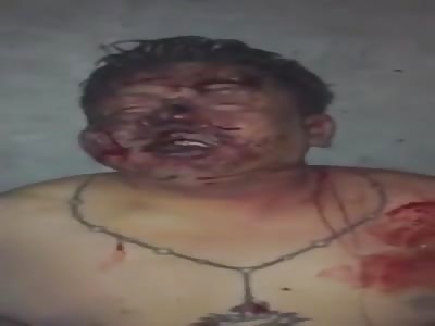 LOL: Caught Thief Disfigured by Victims