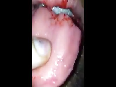 This boy Hate bis tongue 