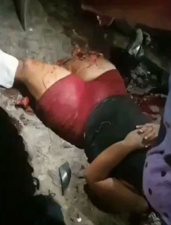 Girl Literally Butchered...It Will Take Time to Recover.