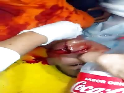 Accident victim receives treatment.