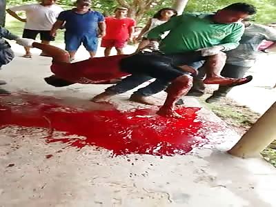 Man's leg almost severed by machete. 