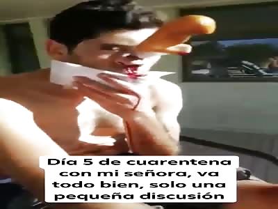 man with a knife stuck in his face