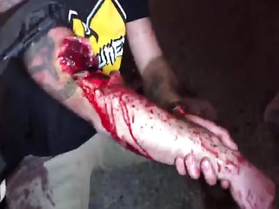 Rioter Shot After Attacking A Man With A Semi Automatic Rifle