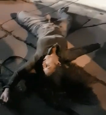 Girl With Huge Tits Sprawled Out after Accident