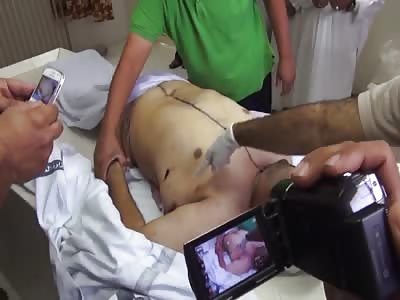 Dead arab is being washed in morgue