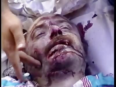 Man murdered on on the street with lots of wounds from machete