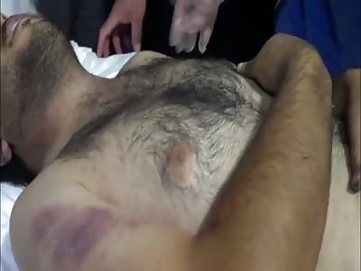 Dead Arab is examined at mortuary.