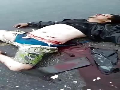 man has his belly torn in accident